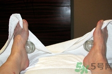 腳底可以拔罐嗎？腳底拔火罐有什么好處？