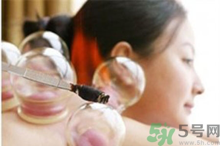 肩膀酸痛可以拔火罐嗎？孕婦肩膀酸痛能拔火罐嗎？