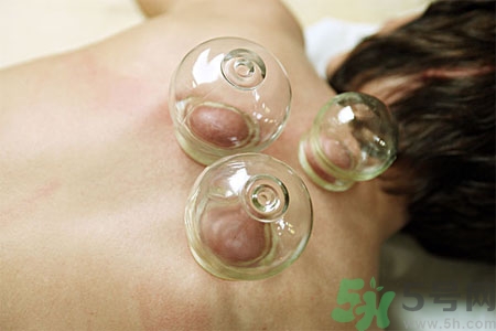 肩膀酸痛可以拔火罐嗎？孕婦肩膀酸痛能拔火罐嗎？