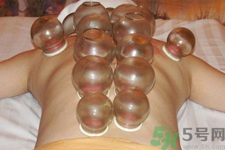 老人能在家拔火罐嗎？老年人拔火罐需要注意什么？