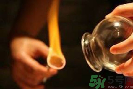 老人能在家拔火罐嗎？老年人拔火罐需要注意什么？