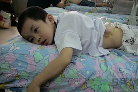 小孩可以拔罐嗎？寶寶能拔火罐嗎？