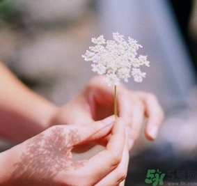 手指被門(mén)夾了有淤血怎么辦？手指被門(mén)夾了有淤血怎么處理？