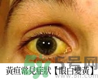 上腹部不舒服有時(shí)疼痛會(huì)不會(huì)是胰臟癌？