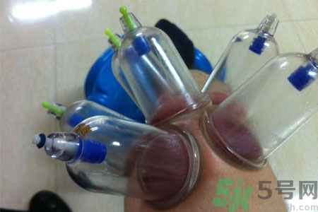 膝蓋能拔罐嗎？膝蓋疼可以拔罐嗎？