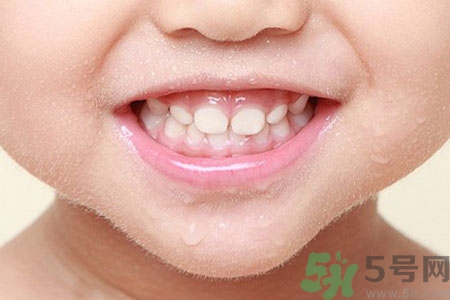 小孩牙齒發(fā)黑怎么回事？小孩牙齒發(fā)黑怎么辦？