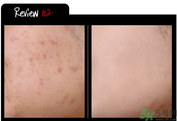 w.lab雪花氣墊黑色款怎么樣？w.lab雪花氣墊黑色和白色區(qū)別？