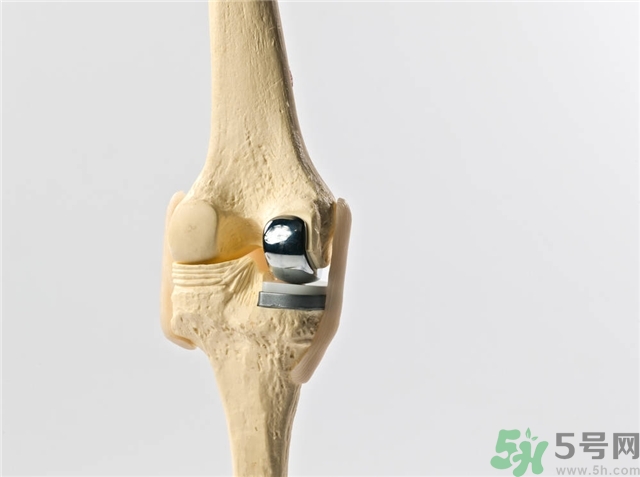 膝關(guān)節(jié)疼痛是怎么回事該怎么辦？膝關(guān)節(jié)疼痛如何治療？