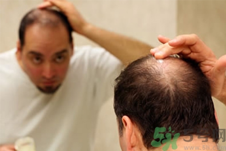 掉頭發(fā)需要檢查什么？脫發(fā)需要做什么檢查？