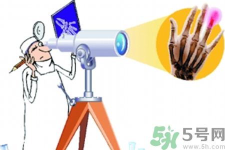 什么年齡測骨齡最好？如何測骨齡？