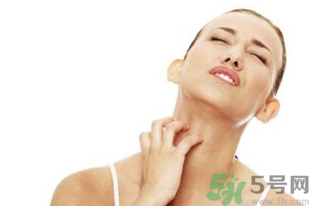 臉過敏發(fā)紅癢怎么辦？臉過敏發(fā)紅癢擦什么藥好？