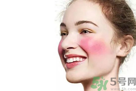 臉過敏發(fā)紅癢怎么辦？臉過敏發(fā)紅癢擦什么藥好？