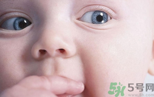 寶寶眼屎多又黃怎么辦?寶寶眼屎多是什么原因 寶寶眼屎多又黃怎么辦?寶寶眼屎多是什么原因