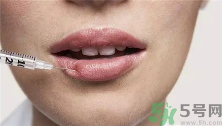 玻尿酸豐唇后多久消腫?玻尿酸豐唇后多久變軟? 玻尿酸豐唇后多久消腫?玻尿酸豐唇后多久變軟?