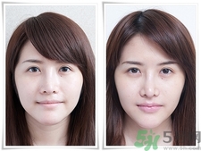 玻尿酸豐唇能保持多久?玻尿酸豐唇后注意什么? 玻尿酸豐唇能保持多久?玻尿酸豐唇后注意什么?