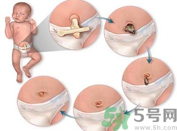 新生兒肚臍可以碰水嗎？新生兒肚臍沒脫落能洗澡嗎？