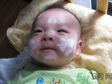 新生兒濕疹可以用爐甘石洗劑嗎？新生兒濕疹的護理措施