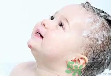 寶寶頭垢是如何產(chǎn)生的？寶寶頭垢怎么去掉？