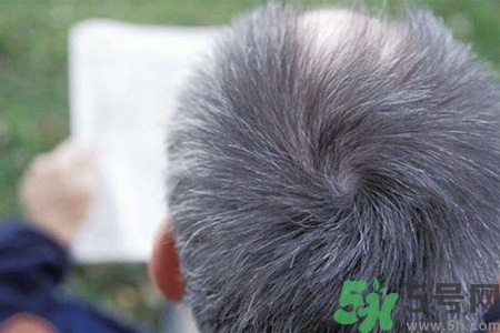 缺什么頭發(fā)會變白？年輕人頭發(fā)變白是缺維生素嗎？