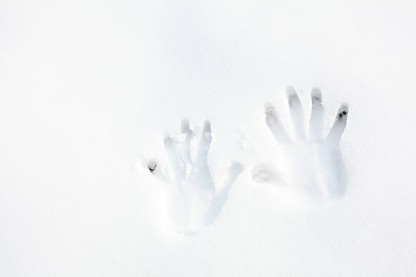 凍瘡為什么會(huì)復(fù)發(fā),為什么總愛長(zhǎng)凍瘡