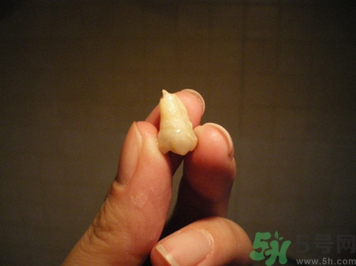 拔智齒能瘦臉嗎?拔智齒后注意事項 拔智齒能瘦臉嗎?拔智齒后注意事項