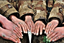 怎樣提前預(yù)防凍瘡比較有效？冬天預(yù)防凍瘡的小妙招