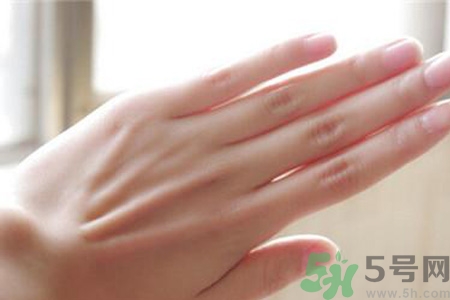 長(zhǎng)凍瘡是缺乏什么營(yíng)養(yǎng)？冬季最缺的4種營(yíng)養(yǎng)素