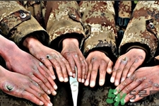 生凍瘡吃什么食物最好？預(yù)防凍瘡吃什么最有效？