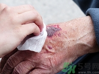 外傷吃什么好得快?外傷吃什么食物好 外傷吃什么好得快?外傷吃什么食物好