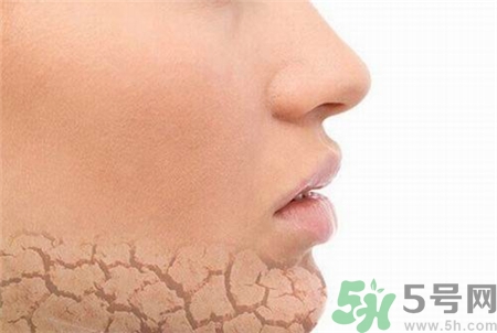 皮膚缺水有哪些癥狀?皮膚缺水會導致哪些問題? 皮膚缺水有哪些癥狀?皮膚缺水會導致哪些問題?