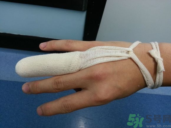 手被門夾了有淤血怎么辦?手被門夾了怎么緩解疼痛 手被門夾了有淤血怎么辦?手被門夾了怎么緩解疼痛