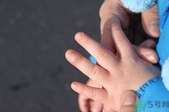 手被門夾了有淤血怎么辦?手被門夾了怎么緩解疼痛 手被門夾了有淤血怎么辦?手被門夾了怎么緩解疼痛