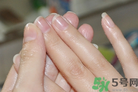 ?指甲上有豎紋是缺什么？指甲上有豎紋是缺維生素嗎？