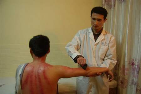 刮痧是什么原理？刮痧后需要注意什么？