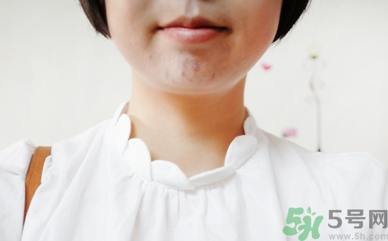 夢詩肌面霜怎么樣?dream skin面霜好用嗎? 夢詩肌面霜怎么樣?dream skin面霜好用嗎?