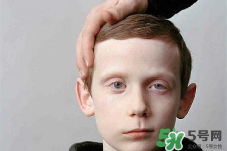 如何預(yù)防面癱復(fù)發(fā)？導(dǎo)致面癱的四大原因