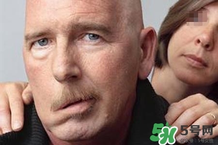 老年人為什么容易得面癱？老年人面癱原因有哪些？