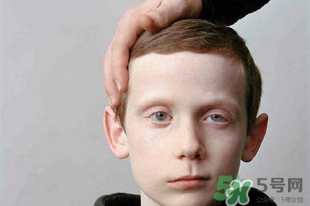 老年人為什么容易得面癱？老年人面癱原因有哪些？