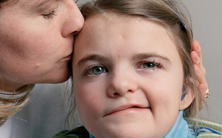 面癱可以徹底治愈嗎 面癱可以用熱毛巾敷臉嗎