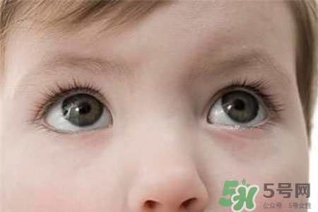 眼睛哭腫了怎么辦？眼睛哭腫了如何快速消腫？