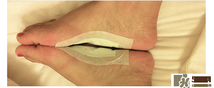 樹之惠足貼真假 樹之惠足貼真假鑒別 樹之惠足貼真假 樹之惠足貼真假鑒別