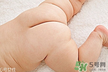 擴(kuò)肛有什么好處？擴(kuò)肛需要注意什么？