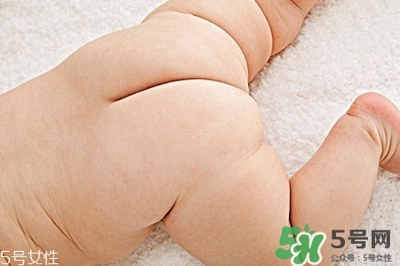 擴(kuò)肛疼嗎？擴(kuò)肛手術(shù)會(huì)很疼嗎？