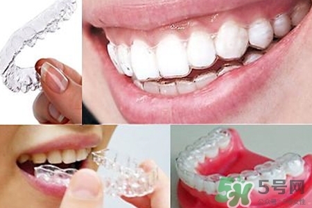 隱形牙套矯正多少錢？隱形牙套多少錢一副？