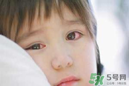 孩子為什么老眨眼睛？孩子總眨眼睛怎么回事？