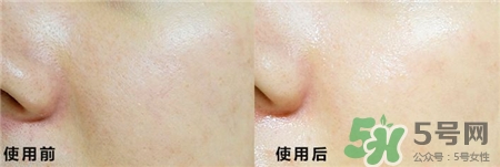 巴諾巴奇錫紙面膜怎么用?banobagi巴諾巴奇錫紙面膜使用方法 巴諾巴奇錫紙面膜怎么用?banobagi巴諾巴奇錫紙面膜使用方法