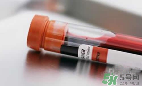 孩子沒出生可以做親子鑒定嗎？孩子沒出生怎么做親子鑒定？