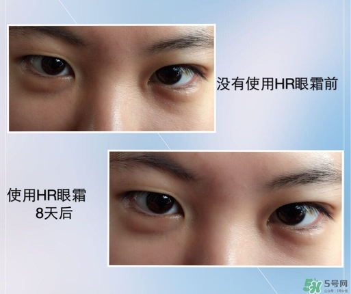 赫蓮娜綠寶瓶眼霜怎么用?赫蓮娜綠寶瓶眼霜使用方法 赫蓮娜綠寶瓶眼霜怎么用?赫蓮娜綠寶瓶眼霜使用方法