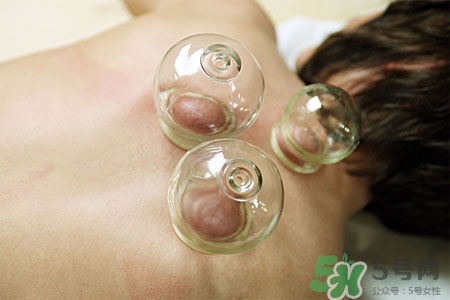 拔罐減肥為什么會反彈？拔罐減肥后不反彈的方法