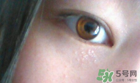 眼霜可以去除脂肪粒嗎?眼霜可以消除脂肪粒嗎? 眼霜可以去除脂肪粒嗎?眼霜可以消除脂肪粒嗎?